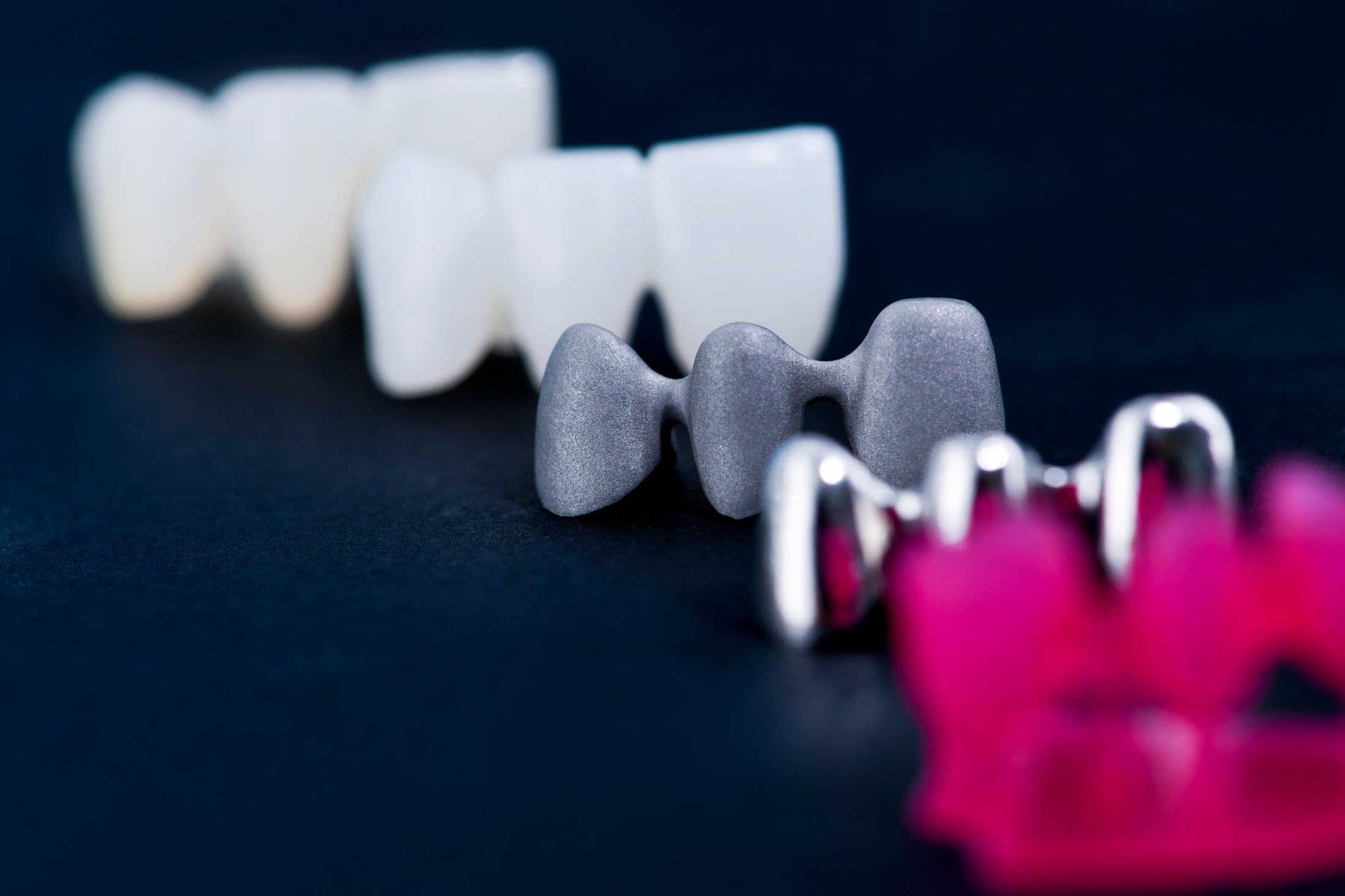 Different Types of Dental Tooth Crowns